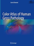 Color Atlas of Human Gross Pathology | اطلس رنگی آسیب شناسی ناخالص انسانی